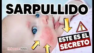🌿🧴 C&oacute;mo CURAR UN SARPULLIDO a mi Beb&eacute; &iexcl;R&Aacute;PIDO Y F&Aacute;CIL!