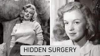 Marilyn Monroe's Hidden Chin Surgery - Medical Files Reveal 60-Year Secret That Caused Her Pain