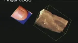 Sonography of Near Field Skin and Subcutaneous Structures