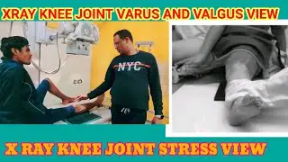 X RAY KNEE JOINT STRESS VIEW VALGUS AND VARUS PROJECTION
