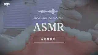 REAL DENTAL SOUND ㅣ 치과 ASMR 🦷 : 충치치료