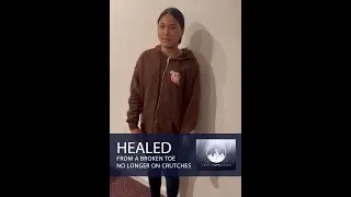 Healed | Broken toe, no longer needs crutches