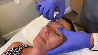 Live Demonstration | Dermaplane and Diamond Glow