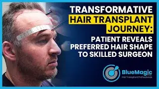 Transformative Hair Transplant Journey: Patient Reveals Preferred Hair Shape to Skilled Surgeon