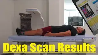 Результаты сканирования Dexa Body Fat после набора массы
