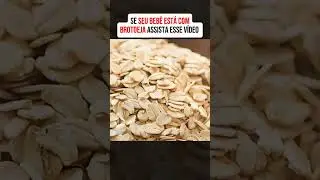 dicas para aliviar as brotoejas no seu beb&ecirc;  #dicas #healthy #remedy #tip #remedioscaseros #brotoeja