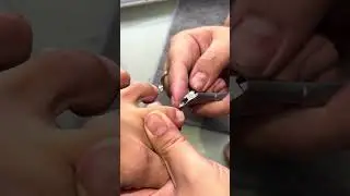 CRAZY Thick Cuticles Removal ep19 #amazing #cleaningenthusiast #nails #trending #viralvideo 