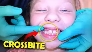 She has a crossbite...this is how we're going to fix it.