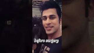 Ken doll before surgery |Don't peek | #kendoll #duckybhai #monitization #mrbeast #rajabsfamily