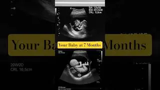 28 Weeks Fetus in the Womb 👶 | Baby Growth & Pregnancy Ultrasound Animation