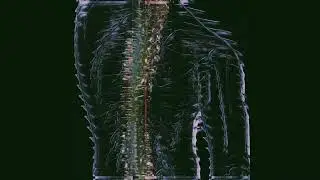 Twinky - Тяжёлый взгляд (Skeler Remix)
