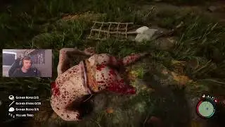 TRAPS ARE TOO FUNNY! - Sons of The Forest