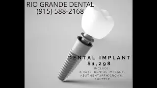 Affordable Dental Implants in Mexico