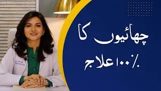 Is there a 100% cure for dark spots? | کیا سیاہ دھبوں کا 100% علاج ہے؟