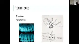 Radiographic Techniques
