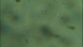 mushroom spores under microscope