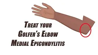 Stretches, Soft Tissue Mobilization and Ice Massage for GOLFER'S ELBOW | Medial Epicondylitis
