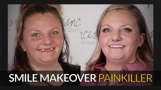 How this Missing Teeth story changed a woman's life - Brighter Image Lab.com