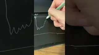 Support and resistance levels for Ripple (XRP) | Daily Trading