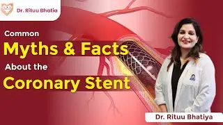 heart stent surgery | myths and facts Angiography | Life of Heart Stent | #heartstents