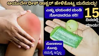 ಎಷ್ಟು ಭಯಂಕರ ಮಂಡಿ, ಸೊಂಟ, ಬೆನ್ನು ನೋವನ್ನು ಗುಣಪಡಿಸುವ ಮನೆಮದ್ದು! Knee Pain | Mandi Novige Manemaddu | tips