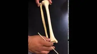 Tibia Fibula Bones