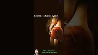 What is Arrhythmia (irregular heart rhythms) ? #medical #heart #video #shorts