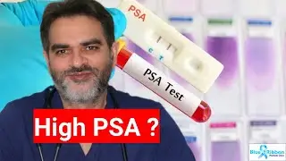 High PSA Treatment |  A complete Stepwise guide !