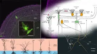 Serotonin (5-HT) in Tinnitus Suppression & Spikes, Cartwheel & Granule Cells (DCN), Thalamus