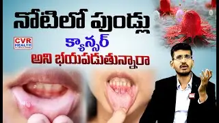 నోటిలో పుండ్లు  తేలికగా వదిసారో  ఈ కాన్సర్ తప్పదు | Cancer Awareness | CVR HEALTH