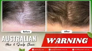 Welcome to Exclusive Webinar: Fastest Hair Regrowth Techniques for Women!
