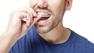 The Invisalign Process | Invisalign vs Braces | Invisalign Cost