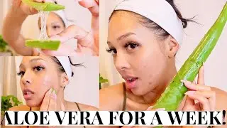 I USED FRESH ALOE VERA ON MY ACNE FOR 7 DAYS!!! pt.2 | BEFORE & AFTER 😳