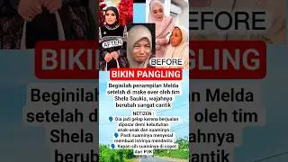 WOW! Melda Safitri Kini Glowing Banget! Netizen: &ldquo;Suaminya Pasti Nyesel Ceraiin Dia! #viral