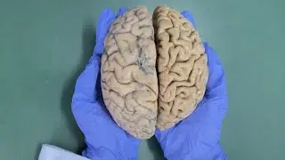 CEREBRUM - An overview Part 1 | NEUROANATOMY | HUMAN BRAIN