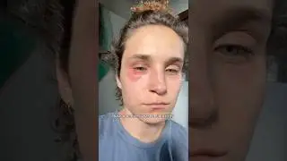 What Mold Does To You!