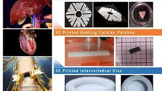 Technology-2: Affordable Healthcare Technologies from Indian Silk