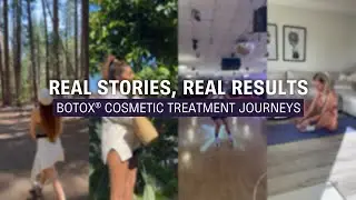 BOTOX&reg; Cosmetic (onabotulinumtoxinA) Treatment Journeys
