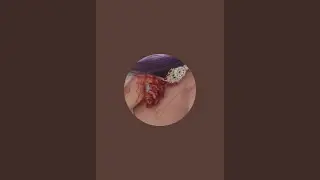 zubiya  is live