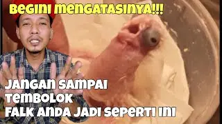 MASALAH TEMBOLOK FALK MENGGELEMBUNG IRITASI DAN MASUK ANGIN
