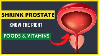 Foods that Shrink Prostate Gland | Best Vitamins for Prostate Health