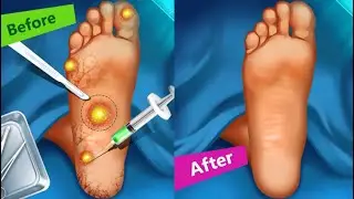 Foot Surgery Hospital Simulator : Doctor Games