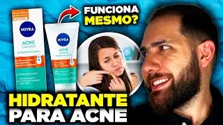 SUMIU MINHAS ESPINHAS? Testei o Hidratante Facial Nivea Acne Control