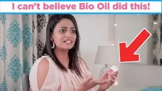 Bio Oil: Review, Benefits, Uses | MomJunction Hacks