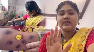 हाथ जल गया 🥹🥲 || My Daily Vlog - 02