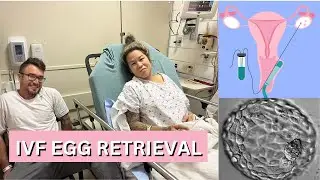 OUR IVF EGG RETRIEVAL | WE FROZE OUR EMBRYOS!! | Male Infertility | Sperm Retrieval