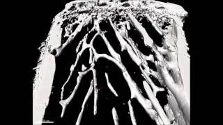 Hematopoietic stem cell visualization in 3D in the bone marrow