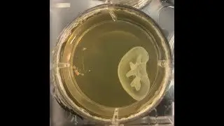 LifeSupport&reg; for FRESH 3D Bioprinting with Allevi