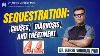 Sequestration: Causes, Diagnosis, and Treatment