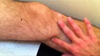 Spleen Channel